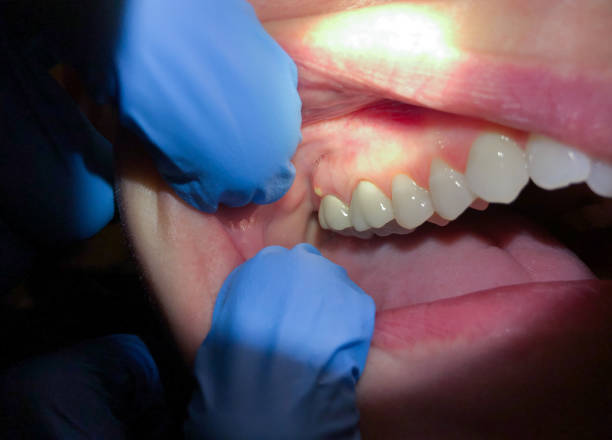 Best Weekend Emergency Dentist in Stuart, VA
