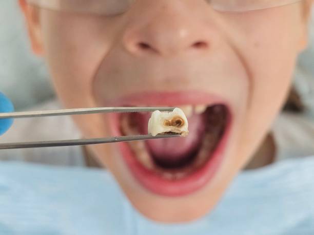 Best Urgent Dental Care for Toothache in Stuart, VA